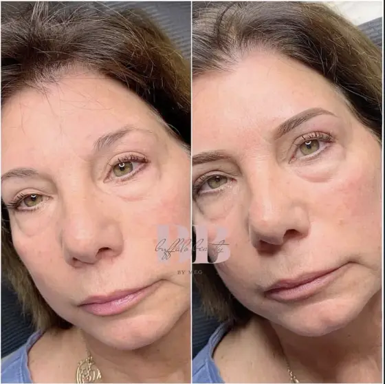 Powder brows before and after, photo 3