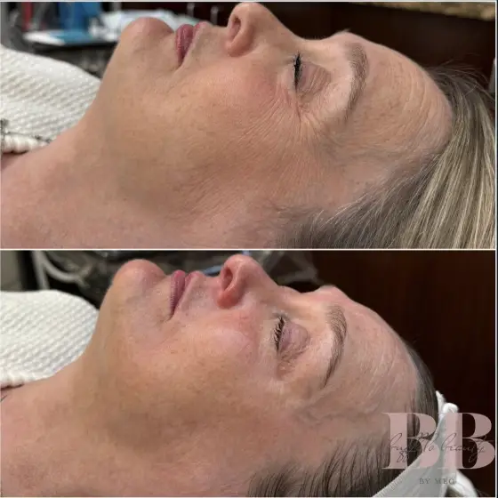Skin treatment before and after, photo 13