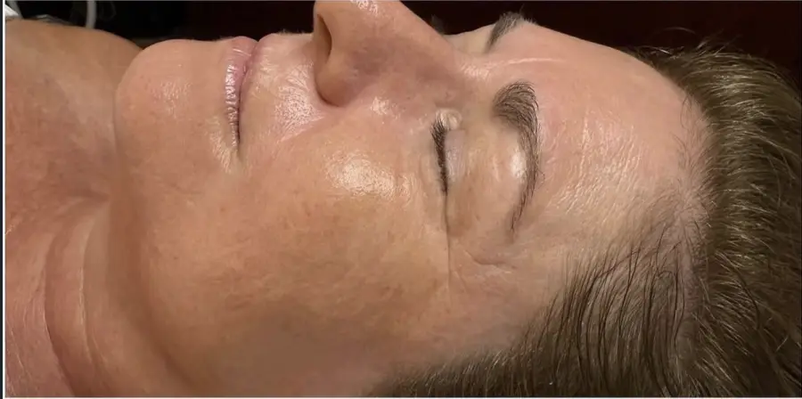 Client’s calm, glowing skin after a facial at Buffalo Beauty